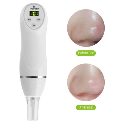 Electric Blackhead Removing Device - Acne Removing Device - Facial Skin Cleaner - Repair And Regeneration Of Skin - Easy To Clean - Suitable For Different Types of Skin - Cleansing Instrument