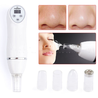 Electric Blackhead Removing Device - Acne Removing Device - Facial Skin Cleaner - Repair And Regeneration Of Skin - Easy To Clean - Suitable For Different Types of Skin - Cleansing Instrument